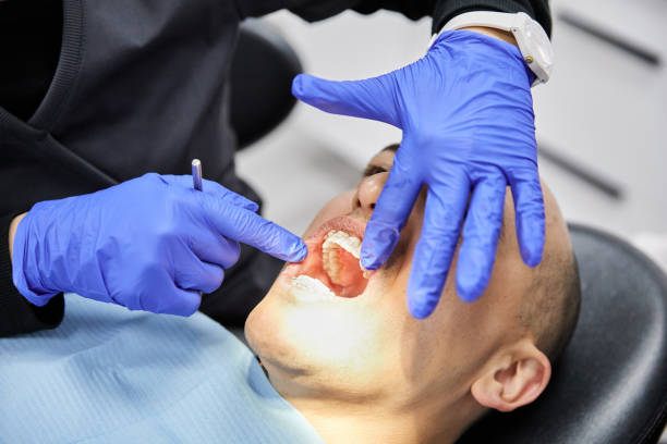 Best Emergency Tooth Extraction in Troutman, NC