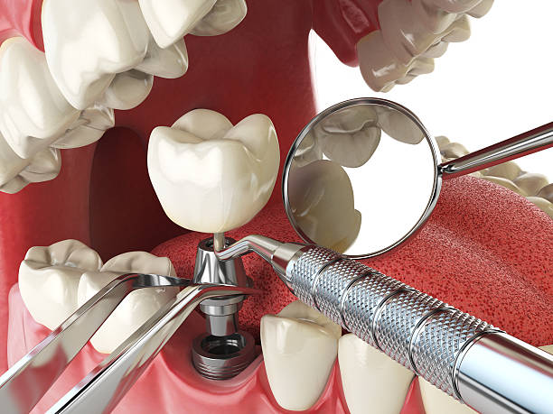 Best Same-Day Emergency Dental Services in Troutman, NC