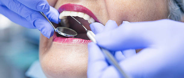 Best Emergency Dental Care for Broken or Chipped Teeth in Troutman, NC